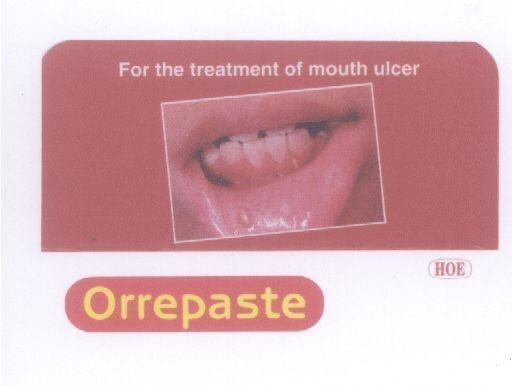Mẫu nhãn hiệu ORREPASTE HOE FOR THE TREATMENT OF MOUTH ULCER